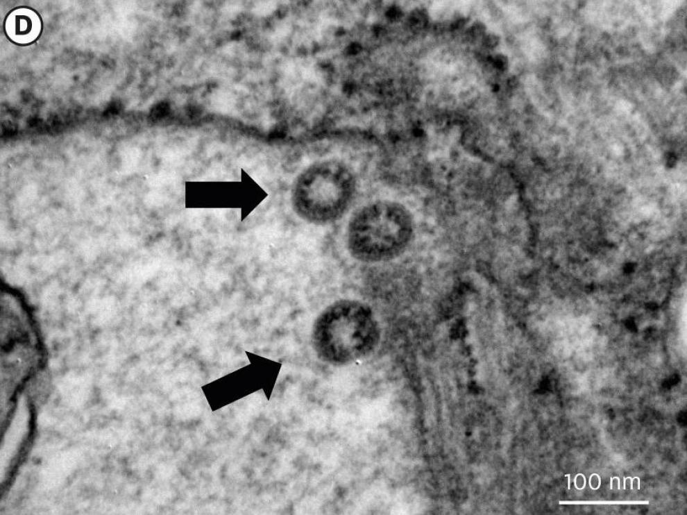 El coronavirus SARS-CoV-2 infecta un cultivo celular.