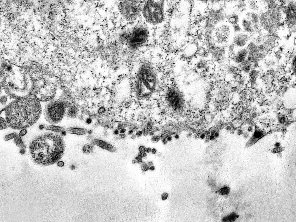 Así infecta el coronavirus a una célula