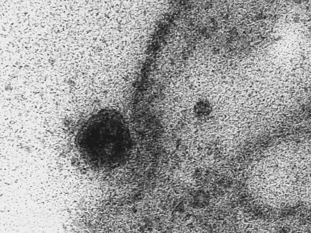 Así infecta el coronavirus a una célula