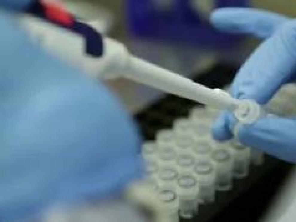 Si se cumplen con éxito los plazos previstos, sus investigadores aseguran que esta vacuna podría distribuirse masivamente a partir de otoño