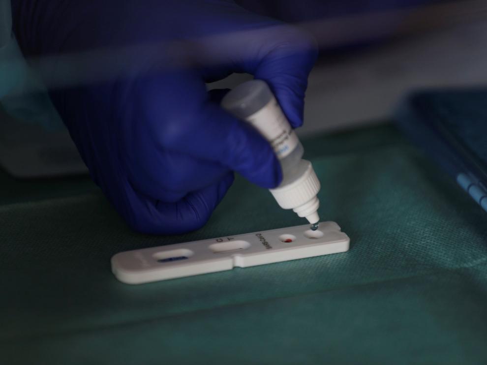 Los test serológicos detectan en sangre los anticuerpos que el organismo ha producido para defenderse del virus.