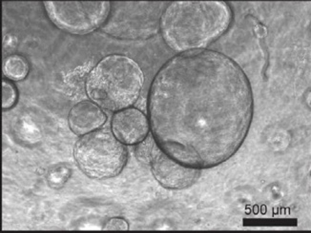 Un equipo internacional de científicos, que trabaja con organoides de hígado, ha logrado multiplicar la generación de células en biorreactor para aumentar las posibilidades de tratamientos para enfermedades hepáticas