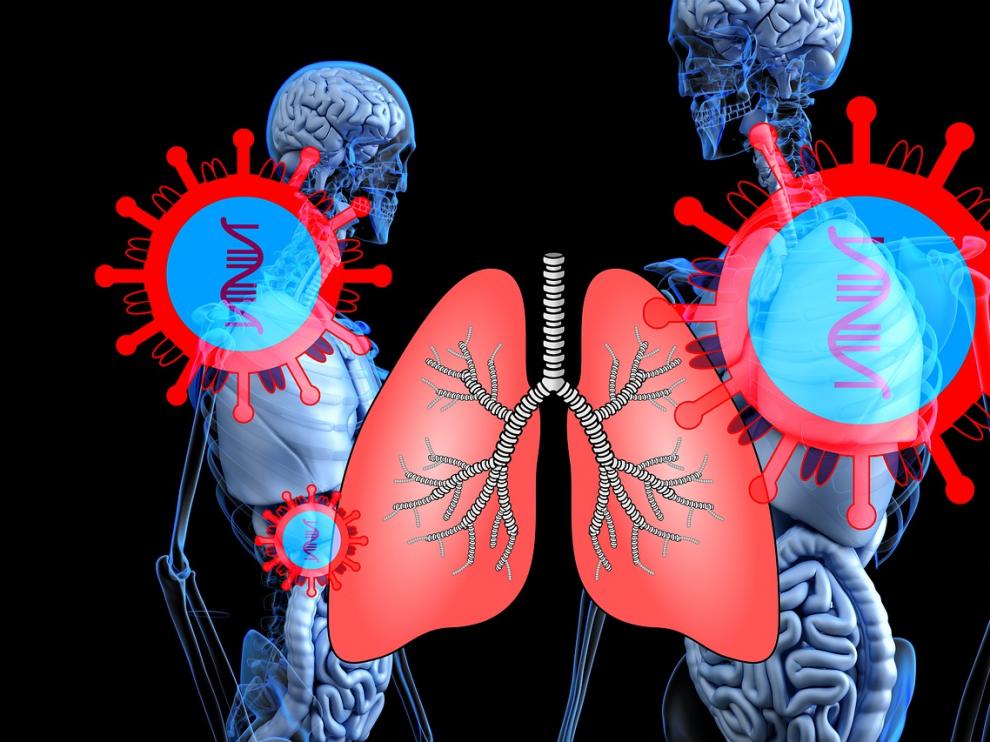 El coronavirus afecta a los pulmones, pero también puede causar decenas de otros síntomas