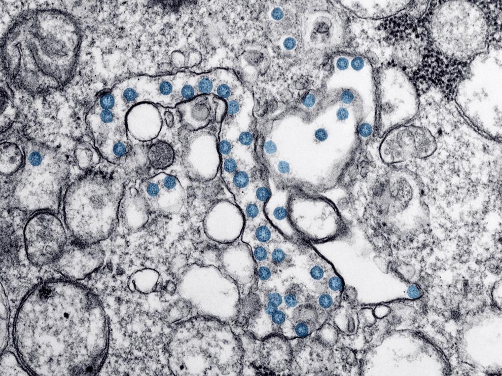 Partículas del virus SARS-CoV-2, coloreadas en azul, vistas al microscopio de electrones.