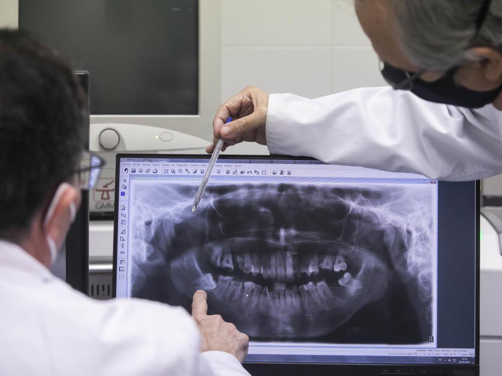 Los doctores Baena y Obón observan la 'foto' de una dentadura tomada con un ortopantomógrafo.