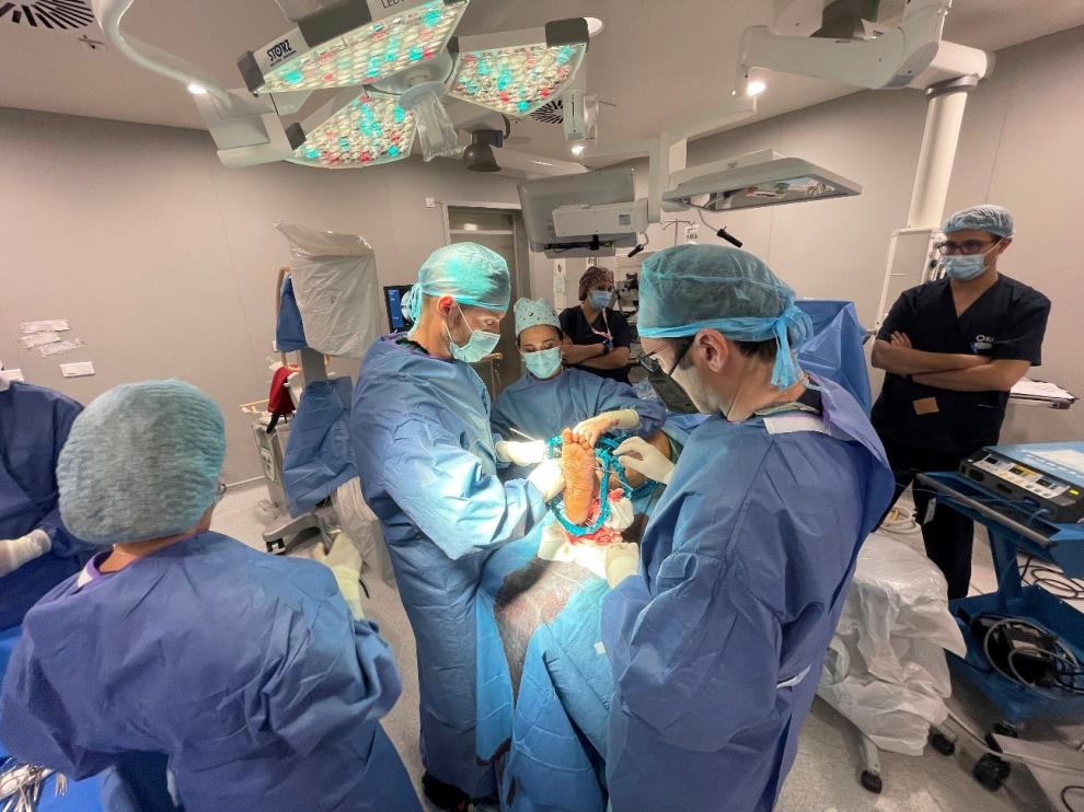 La Dra. Lambán y el Dr. Blanco, con la colaboración del Dr. Rigol, llevan a cabo la cirugía del pie diabético en la Clínica HLA Montpellier.