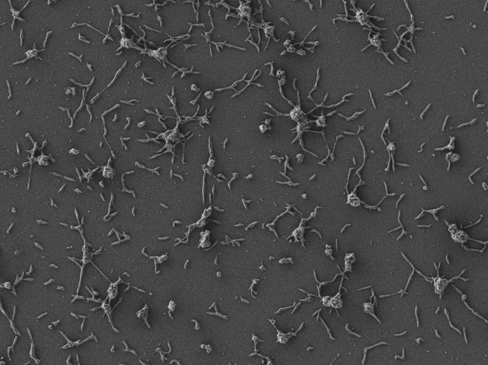 Células de Mycoplasma pneumoniae, pequeñas bacterias que están naturalmente adaptadas al pulmón humano.