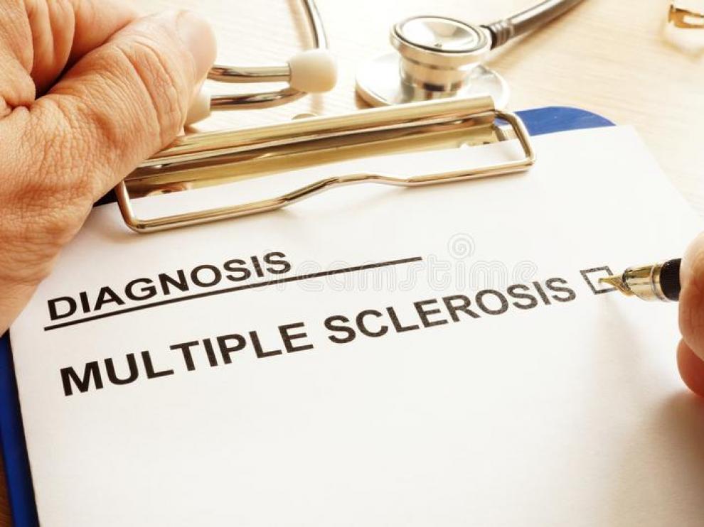 Las causas de la esclerosis múltiple todavía se desconocen.