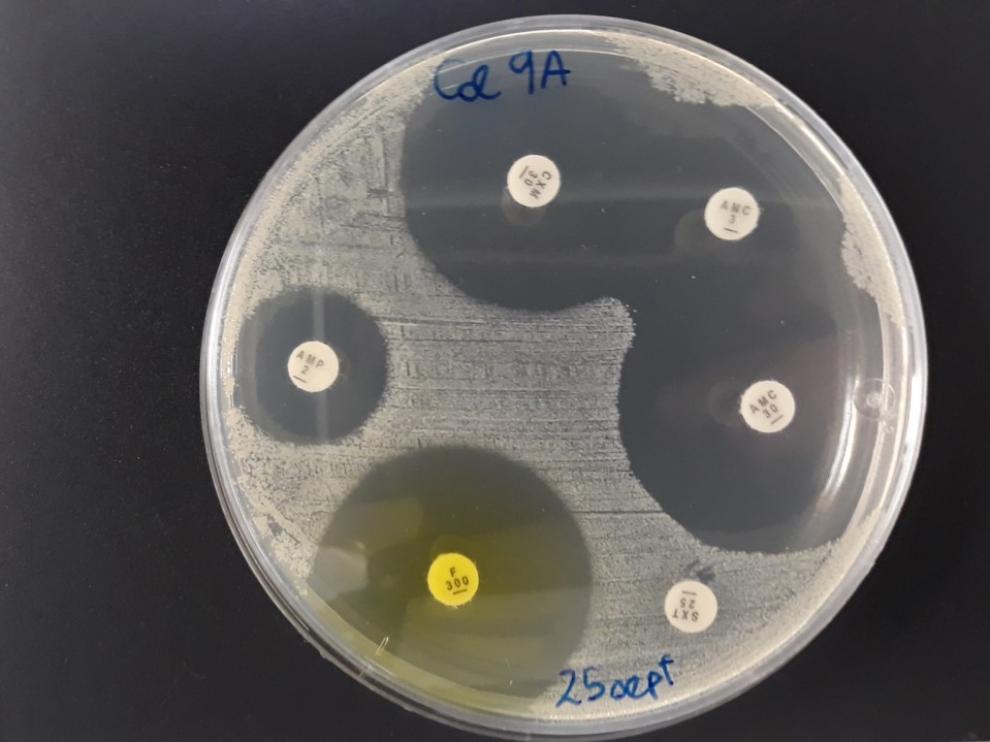 Cultivo bacteriano que resiste la acción de un antibiótico mientras los otros son eficaces contra él