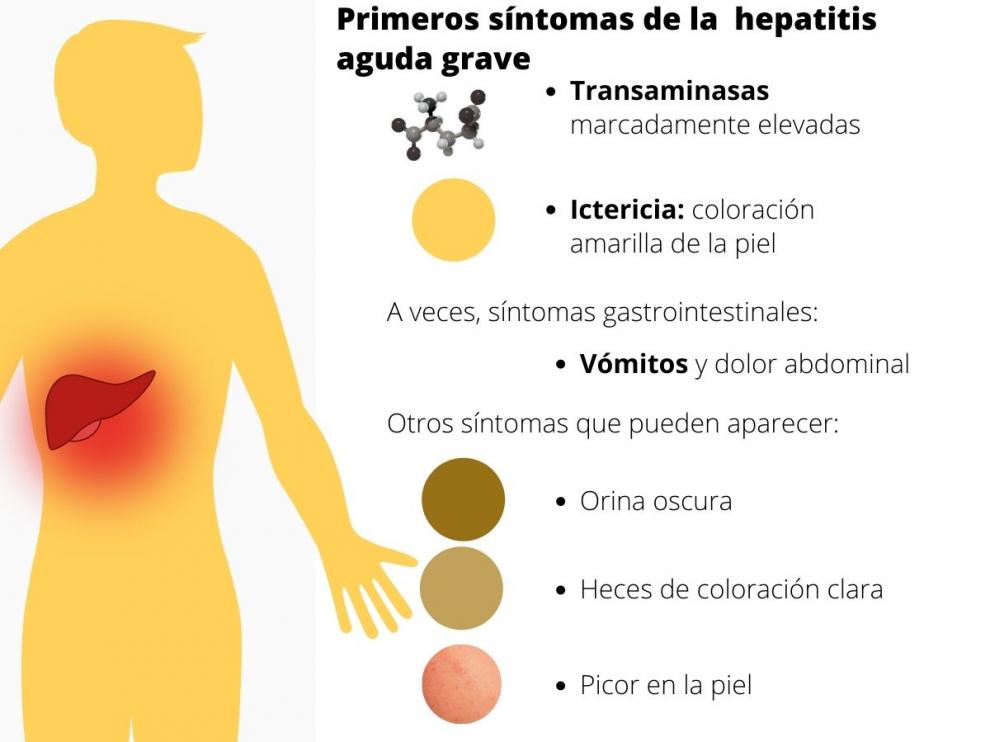 Síntomas de los nuevos casos de hepatitis infantil.