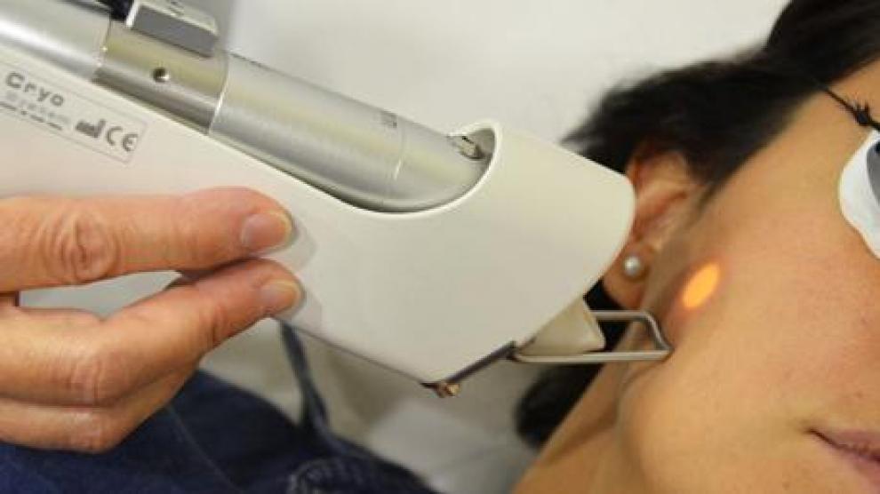 Depilacion laser deals facial opiniones