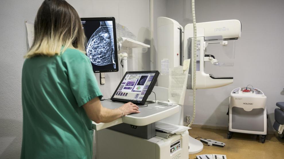 Analizando mamografías