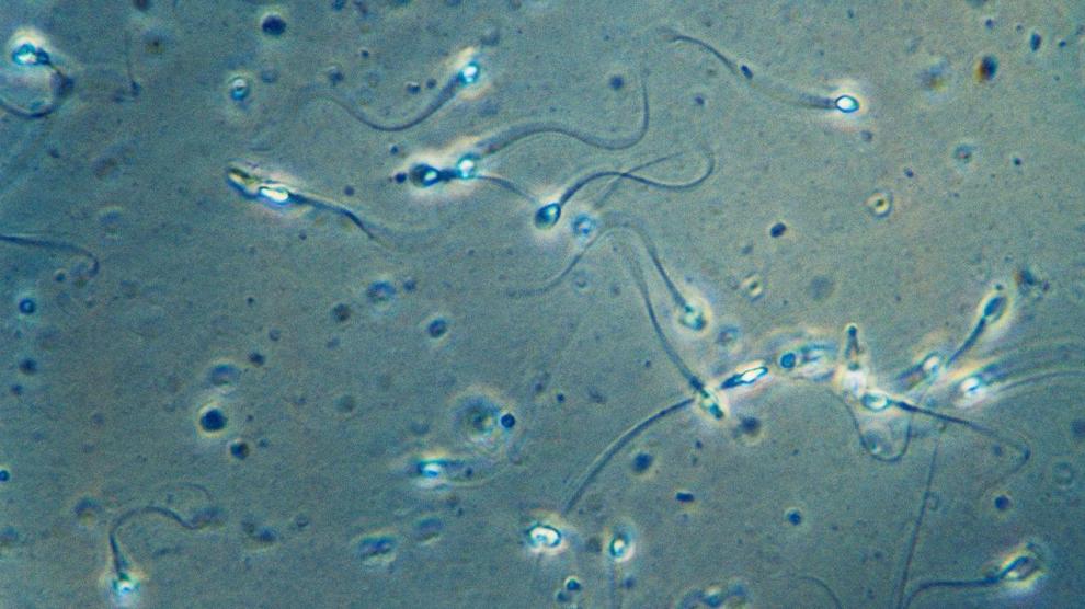 Espermatozoides.
