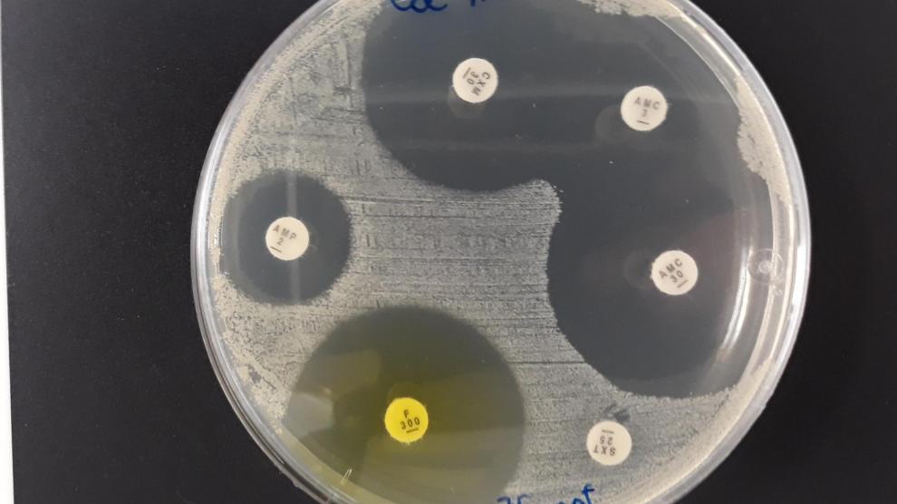 En esta placa de Petri se cultiva una bacteria y cada uno de estos discos de papel está impregnado con un antibiótico distinto. Algunos impiden que la bacteria crezca, y vemos una zona circular libre alrededor. Pero esta bacteria es resistente al antibiótico de abajo a la derecha; a su lado crece perfectamente.