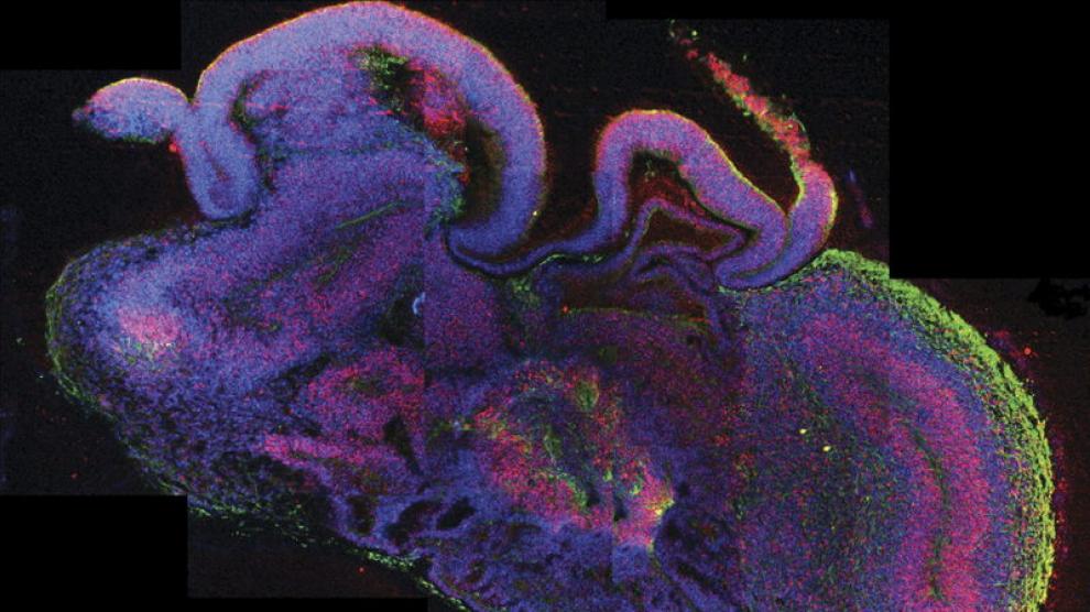 INVESTIGACIÓN NEURONAS  Rodrigo Quian Quiroga, neurocientífico