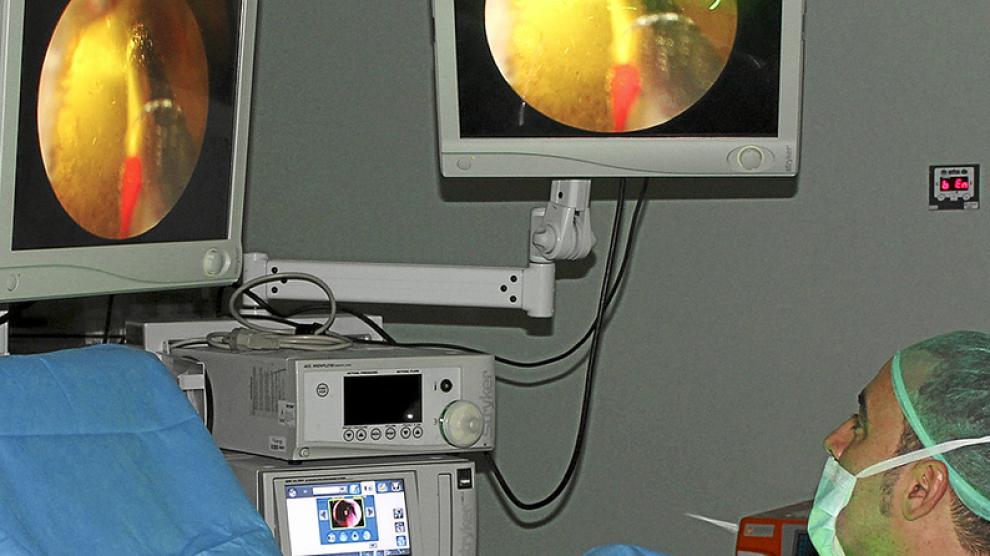 Láser Verde - Instituto de Cirugía Urológica de Málaga