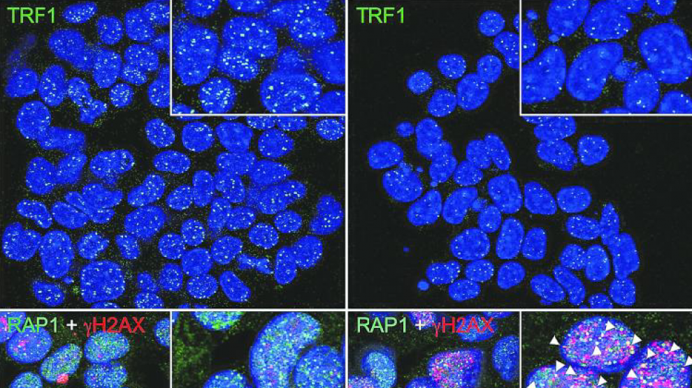 Las células de cáncer de pulmón tratadas con el inhibidor de TRF1 del CNIO muestran menos TRF1 unido a sus telómeros y un mayor daño del ADN telomérico y, por tanto, una mayor desprotección de los telómeros que las células cancerosas sin tratar.