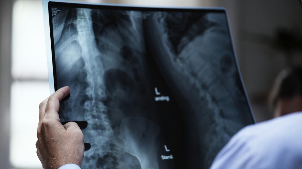 El 28% de los hombres estudiados de 35 a 50 años de edad corre riesgo de osteoporosis.