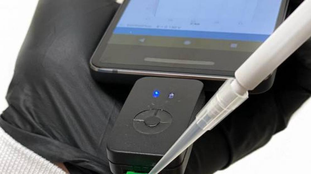 El test que detecta la covid-19 en cuatro minutos, desarrollado por el biotecnólogo español César de la Fuente.