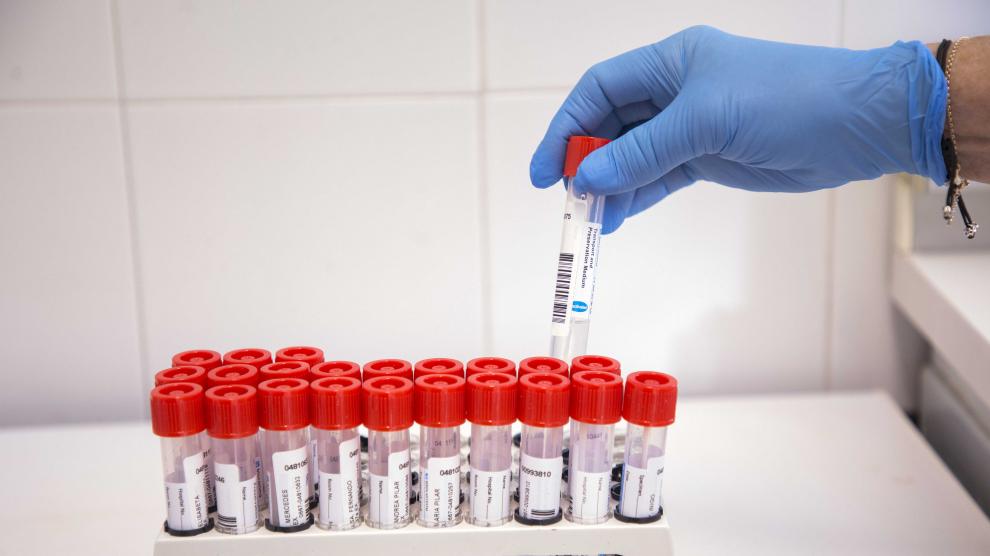 Realización de pruebas PCR de coronavirus en el Hospital Clínico de Zaragoza, este martes.