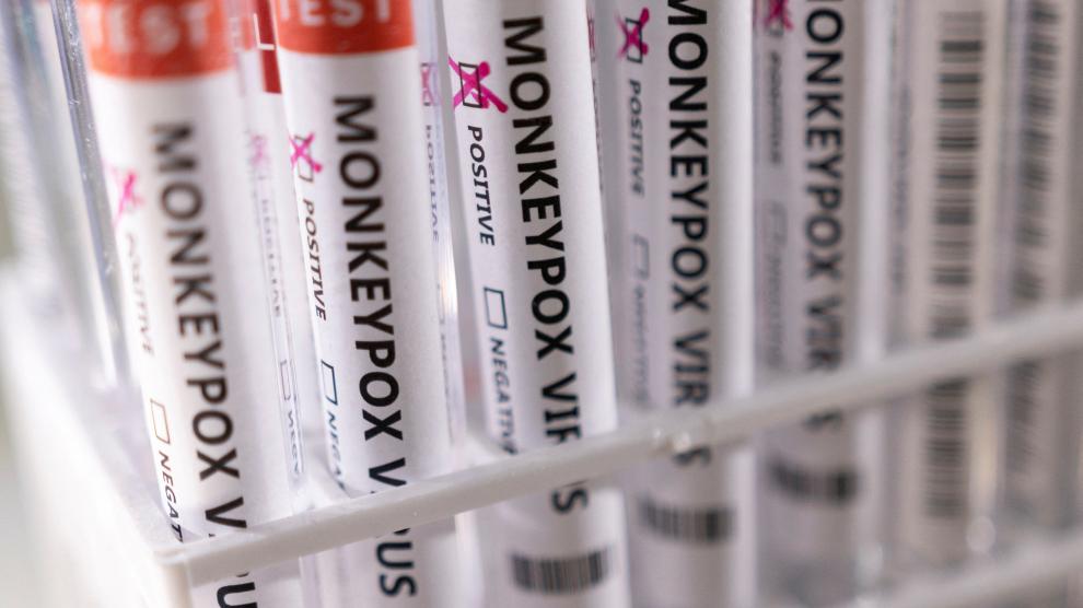 FILE PHOTO: Illustration shows test tubes labelled "Monkeypox virus positive\