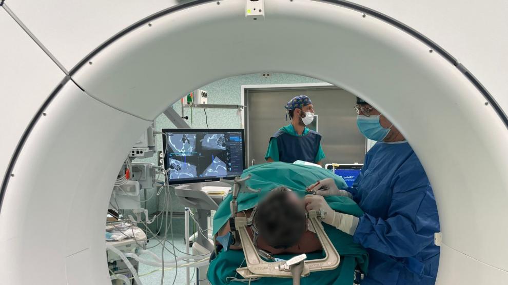 Un momento de la intervención llevada a cabo en el Hospital Miguel Servet de Zaragoza