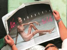 La anorexia alcanza en Aragón las cifras más altas de incidencia