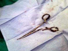 Retiran unas tijeras que llevaban 18 años en el estómago de un vietnamita