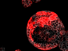 Células responsables de las recaídas del cáncer de colon