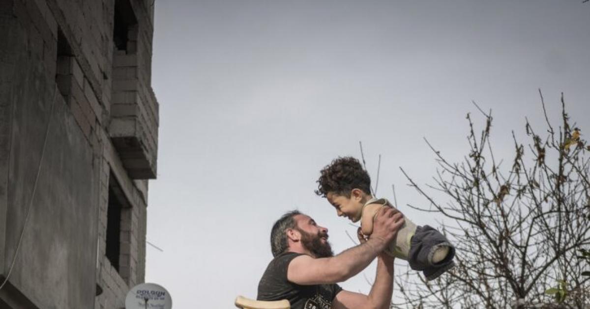 Italia Se Moviliza Para Ayudar A Mustafá Un Sonriente Niño Sirio Sin Extremidades 