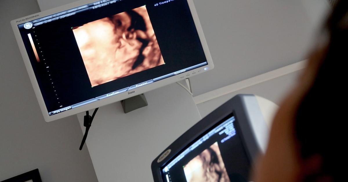 Polska udoskonali wytyczne dotyczące aborcji, jeśli życie kobiety jest zagrożone