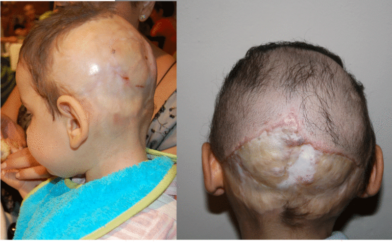 Antes y después del tratamiento